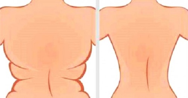 Bí chiêu loại bỏ mỡ thừa ở vùng nách – lưng – hông trong 3 tuần
