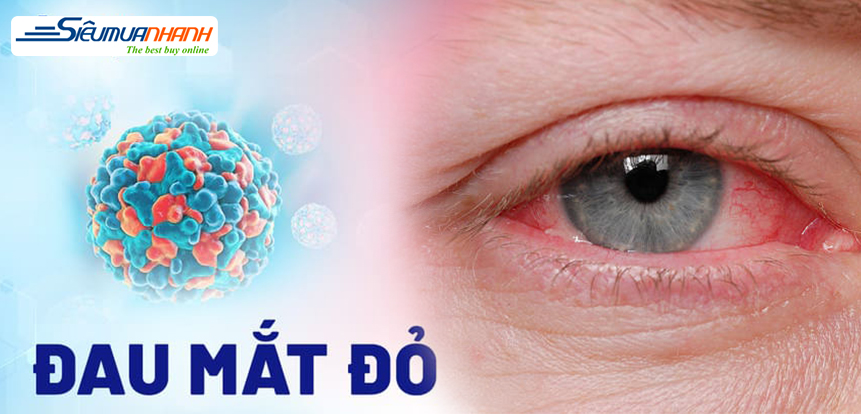 Nguyên nhân phổ biến gây đau mắt đỏ và cách nhận biết
